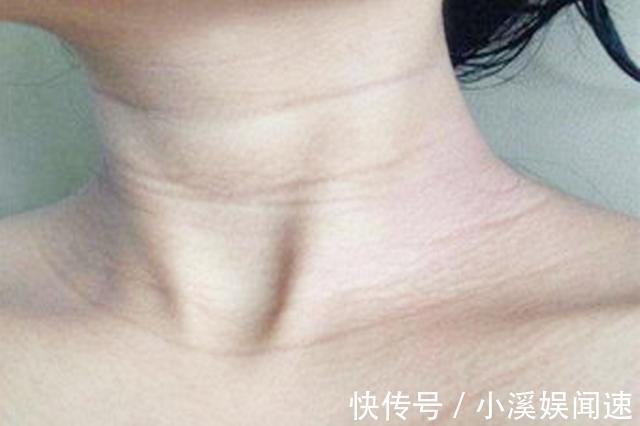 发育|孕妈睡觉,这两种症状频繁出现,说明胎儿大脑发育好,不用担心