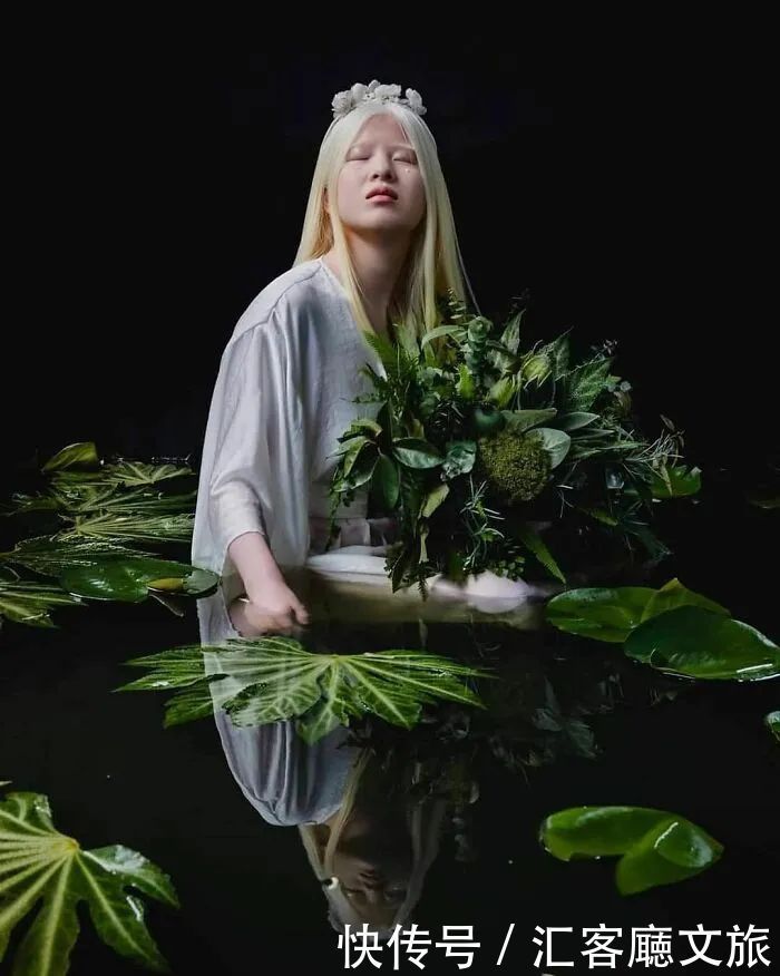 逆袭|因“全身雪白”被遗弃的中国女孩,逆袭成超模的故事让人泪目