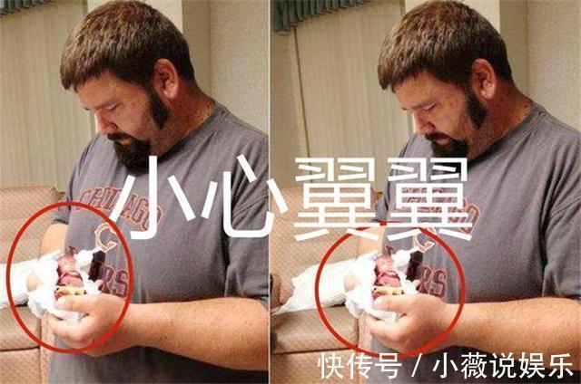 孕妇|世界上最小的婴儿宝宝,身长同一支钢笔,如今过得怎么样?