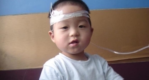 舌苔|5岁男童长期积食不在意,拖成“疳积”,医生:家长太无知了