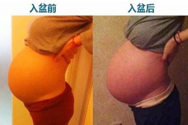 趾骨|孕妈出现“五感觉”,肚子出现“三变化”,说明胎儿已经入盆了