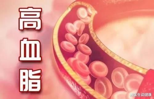 升脂|3类蔬菜已进入“升脂”名单,医生:高血脂人群需注意,建议少吃