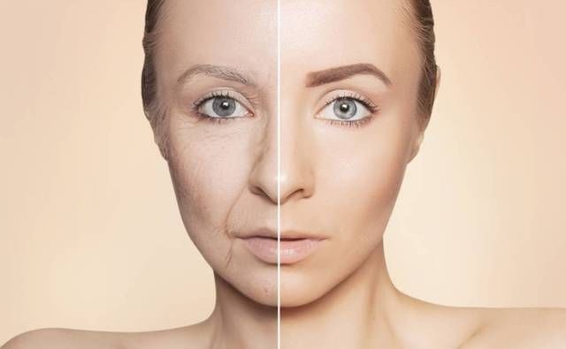 美得有名堂｜面部衰老不要怕！深度了解面部年轻化 你也可以冻龄