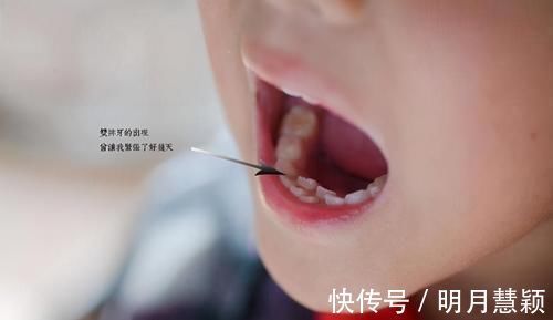 宝宝|宝宝长出吓人的双排牙,只因宝妈准备饮食时,多做了一件事