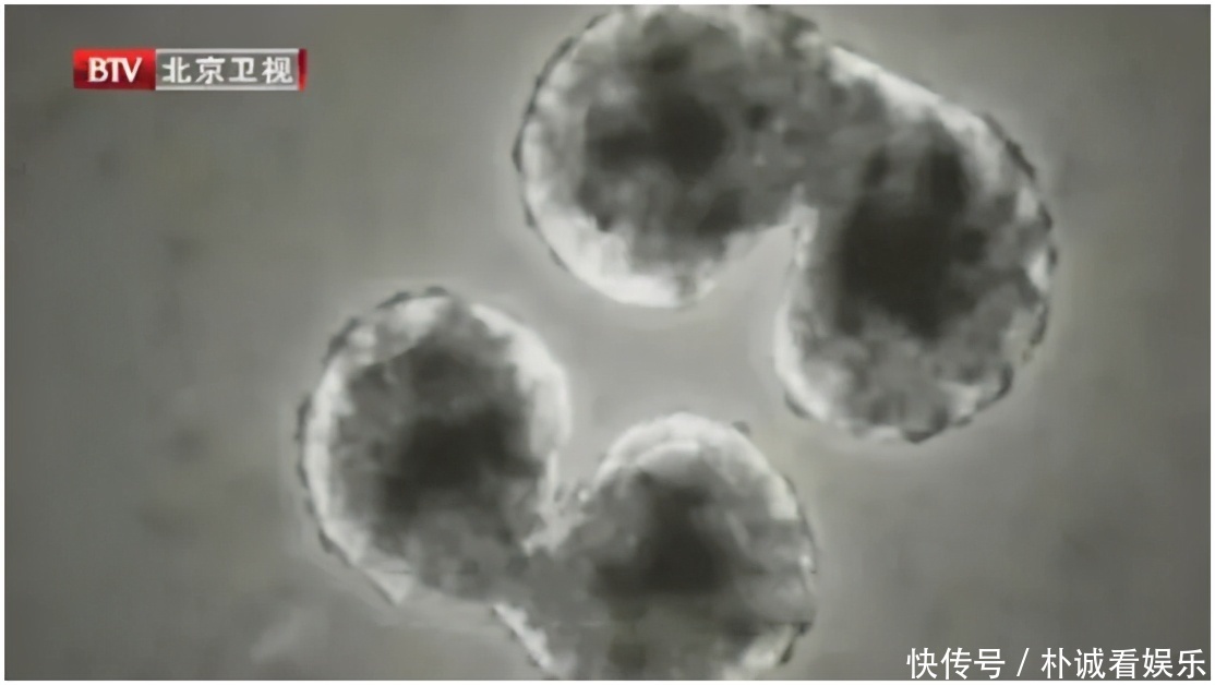 这些炎症可能比癌症更可怕,发病快、致死率高