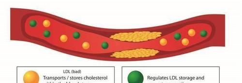部位|血管有没有堵塞,看身体哪个部位就能知道?心血管医生告诉你