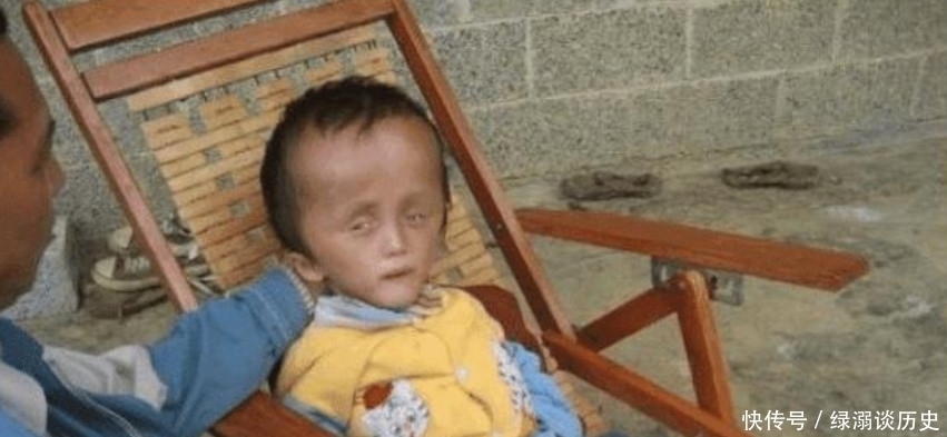 孩子|10年过去了，曾经喝过三鹿奶粉的孩子，如今变成这个样子！