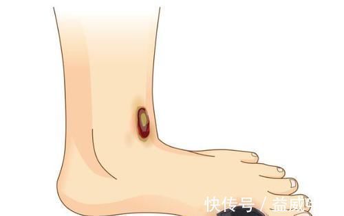 视力|身体出现这6种症状，糖尿病可能已经出现了，别后知后觉