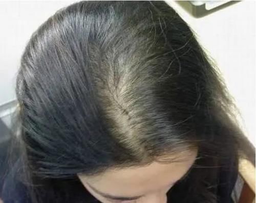 食物|气血不足多半会长斑,多吃4种食物,或让皮肤白嫩更年轻