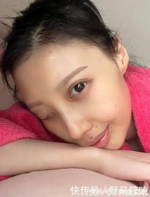 抗癌歌手|恭喜！“最美抗癌歌手”李明蔚将接受第三期疗程，已经抗癌9年