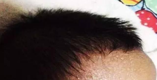 宝宝|这个“夏天神器”让宝宝成“脑瘫”,大多家庭仍在用,家长快住手