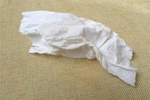 原浆|黄色的卫生纸和白色的卫生纸,哪种好?医生:一种卫生纸,赶紧扔