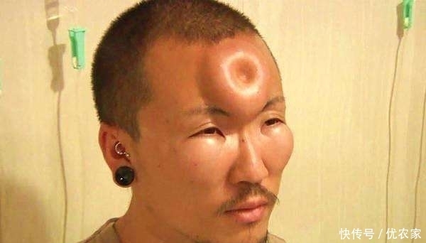 现实版的”脑子进水”,日本人流行的整形方式,我们读不懂的时尚