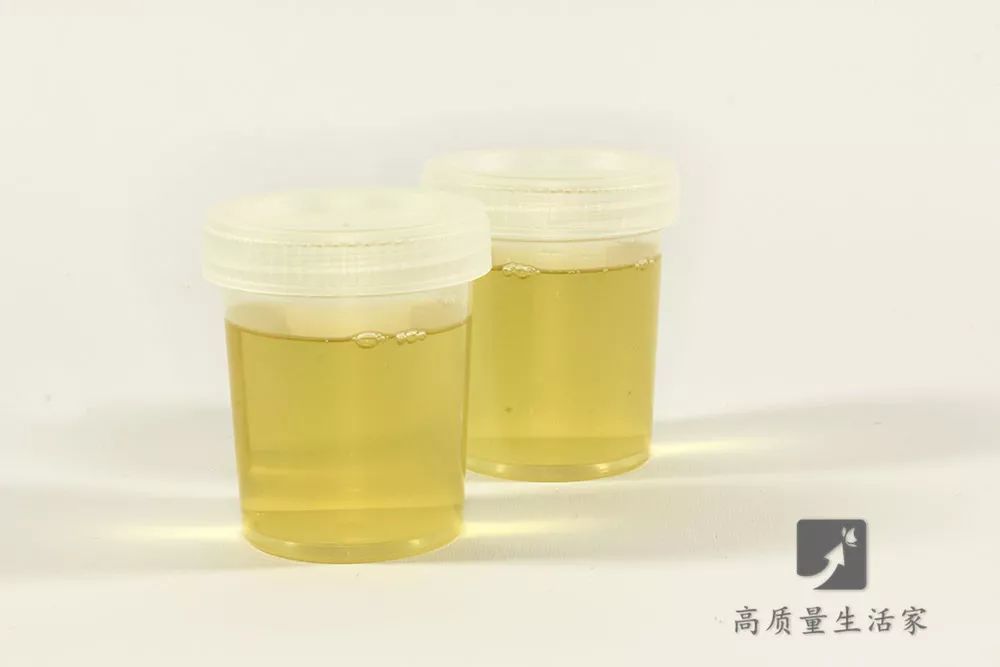 小便|尿中有一层泡沫,是得肾病了?小便泡沫多,可能还暗示这些问题