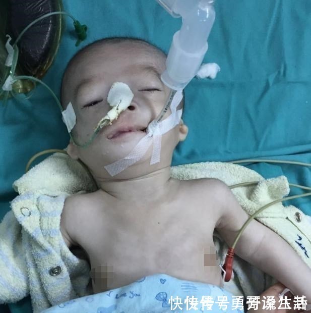 “鸟脸”妈妈不顾劝阻生二胎,二宝没躲过遗传,是任性还是母爱