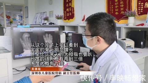 宝宝|得了这病，半岁宝宝脚趾比香蕉还粗！不注意还会复发…