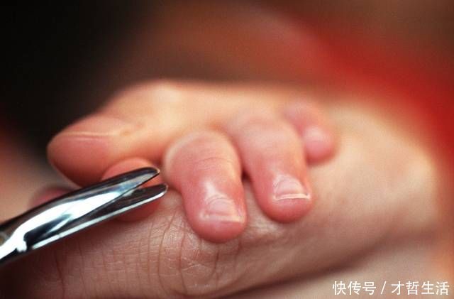 倒刺|指甲出现这4种情况,预示着宝宝的健康问题!宝妈赶紧检查一下