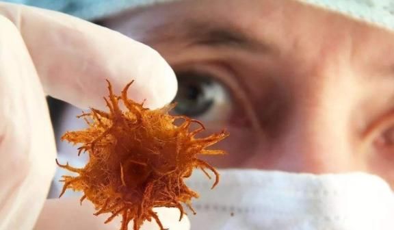 年轻人|连医生都“躲着走”的3种水果,可能多数年轻人还在吃