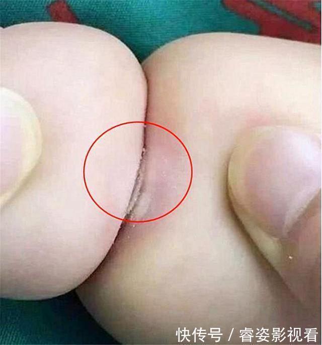 孙子|奶奶养出“米其林”宝宝,炫耀孩子吃得好,好心人:快去医院检查