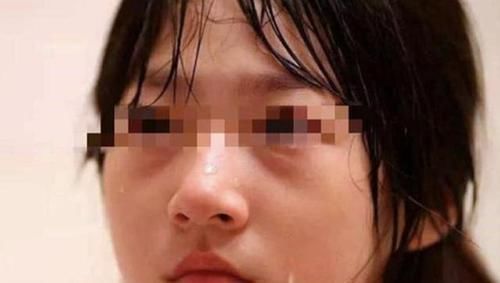 母亲|3岁女孩没照顾好弟弟,被母亲暴力教育,大口吐血却仍要抱抱