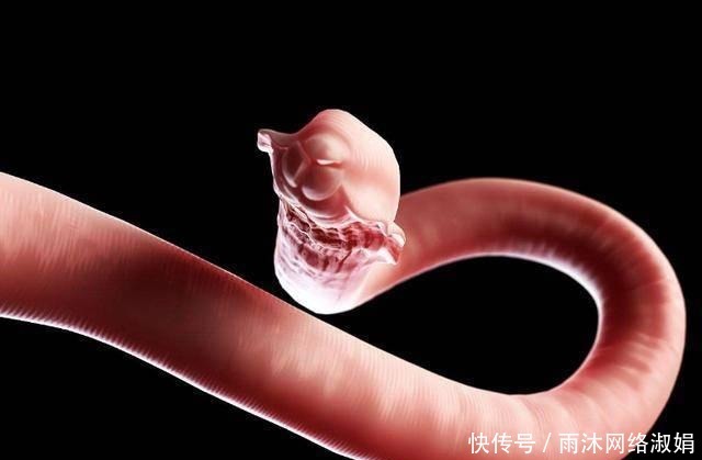 孩子|孩子出现这5种症状，要注意宝宝肚里可能长蛔虫啦