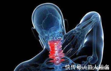 颈椎|颈椎差的人,多揉3个穴位,多吃3物,舒经活络、身体“轻如飞燕”
