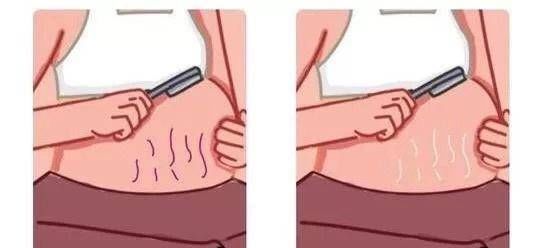 购物车|当母亲说她有了第一个孩子时,医生发现她生了一个被这一部分出卖的孩子她无法掩饰