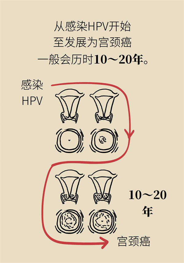 预防|失去疫苗接种最佳时机的女性，如何预防宫颈癌？