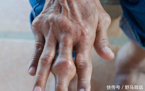 身体|身体出现这5种症状，或暗示你肺癌将至，趁早检查