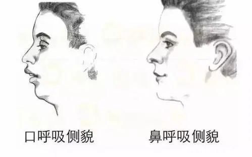 行为|这个行为，毁颜、毁智商!家长赶紧给娃看下，自测方法在这里!