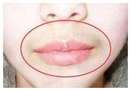 女人们|有妇科病的女人,嘴巴可能有这四种现象,希望你一个都不占