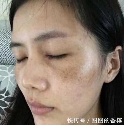 专治色斑的好物居然是香菜?难怪很多美女都在偷偷用,我先收藏了