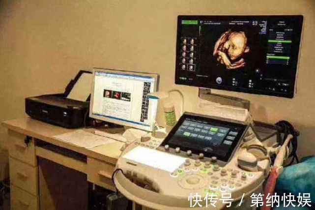 孕妈|做四维彩超时,为什么胎儿总是不露脸