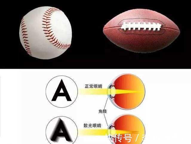 屈光力|散光是怎么回事?和近视一样吗?今天就帮你弄明白