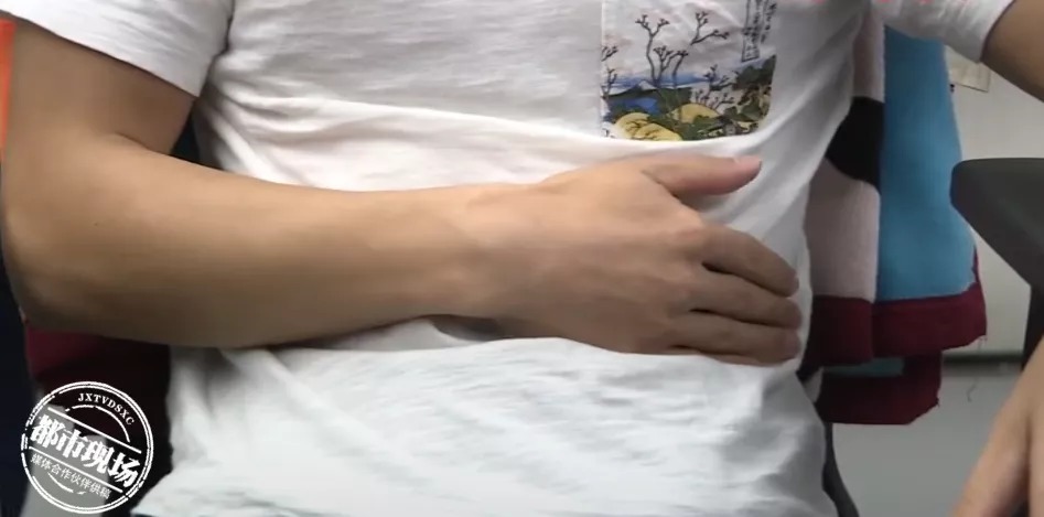 十二指肠|24岁男子“怎么都吃不胖”,一查不得了了