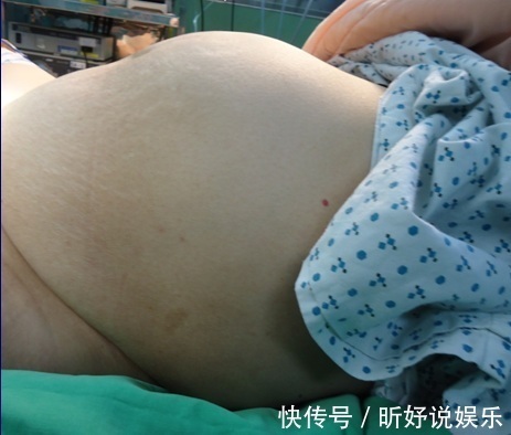 怀孕|怀孕八个月去产检,医生表示必须尽快手术,剖开肚子医生连退三步