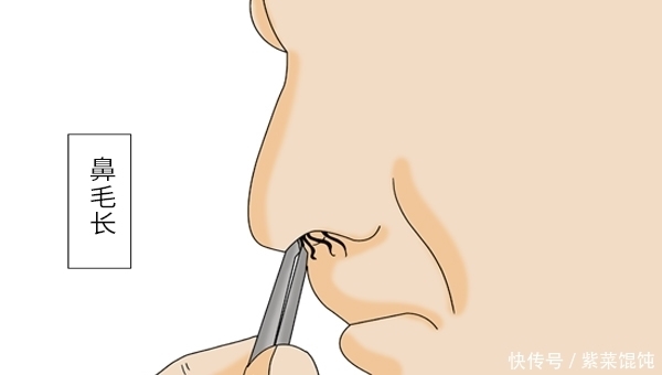 鼻毛“窜”出鼻孔说明什么?该剪还是该拔?建议您看完再决定