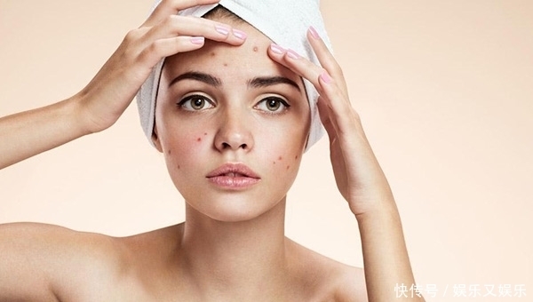 一个美容妙方!解决脸部痘痘斑斑、坑坑洼洼、油油腻腻!美艳如花