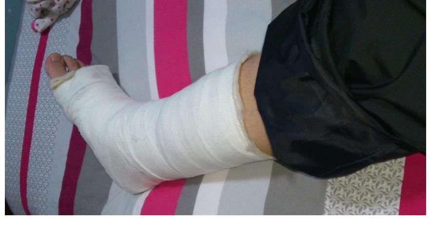 大爷|58岁大爷养骨半年，骨密度从-2.5到0.9，医生建议：2物可适当多吃