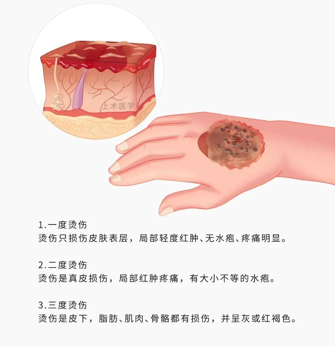 抢救|记住5个急救「黄金时间」，关键时刻能救命