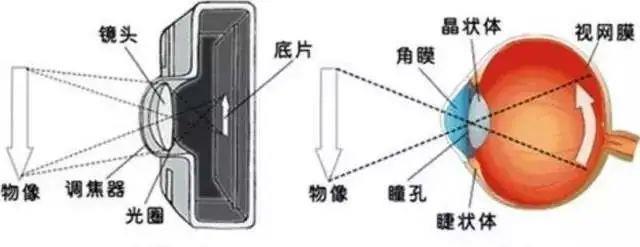 视力|高度近视对患者的危害很大,那么,高度近视为什么一定要查眼底呢