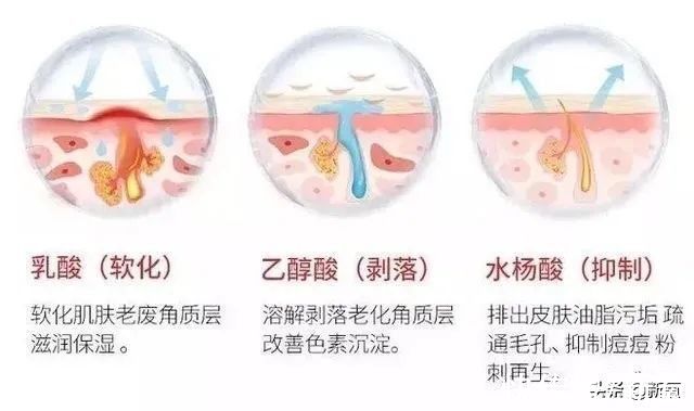 脂肪粒|她鼻背两旁的小疙瘩，到底是啥？