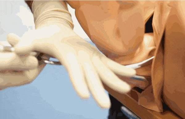 消退|孩子脸部“产钳印”没消退,婆婆怨儿媳没本事顺,网友好心凉