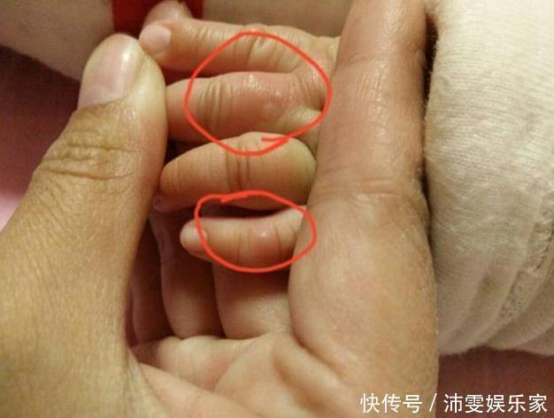 小宝宝|孩子聪明不聪明,看看小手就清楚了,智商的高低手掌上有信号