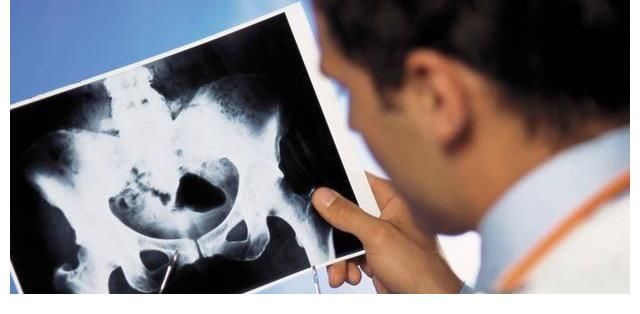 营养物质|吃一口等于8杯豆浆，骨科主任：骨不好的人坚持吃，还你“钢铁骨”