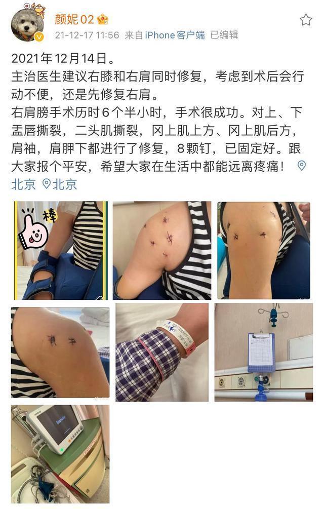 朱婷|質(zhì)疑中國(guó)女排？朱婷出國(guó)治療，3大主力手術(shù)，球隊(duì)或?qū)⒂拮?
onload=