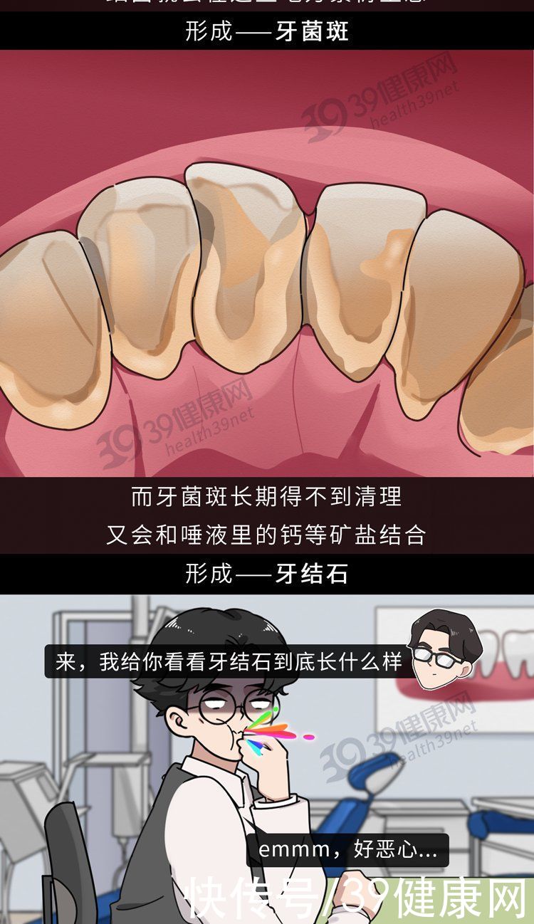 中华|不洗牙，你永远不知道牙齿里面有多脏！看完这篇就拿定主意了