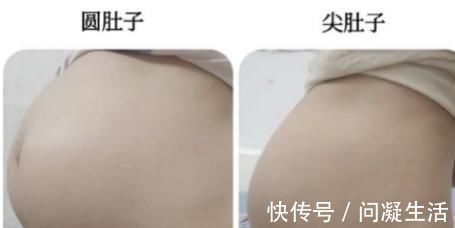 妈妈们|肚子长毛、有黑线？怀孕后肚子的这几点变化最明显