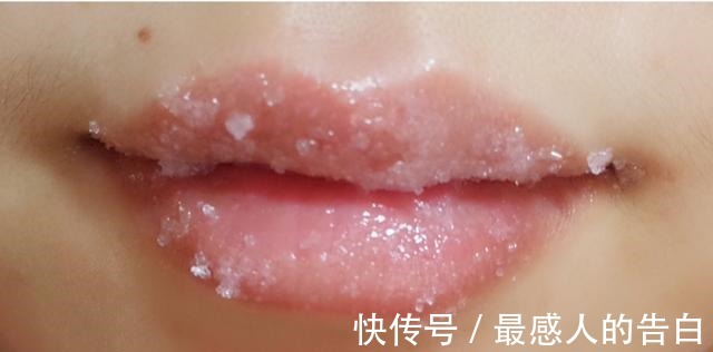 皮肤干燥 唇部护理有多重要没做好涂再贵的口红也是浪费，很多人都忽视了！