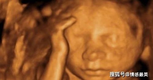 检查|孕期做四维彩超，为什么胎儿喜欢捂住脸不让看？孕妈要知道原因